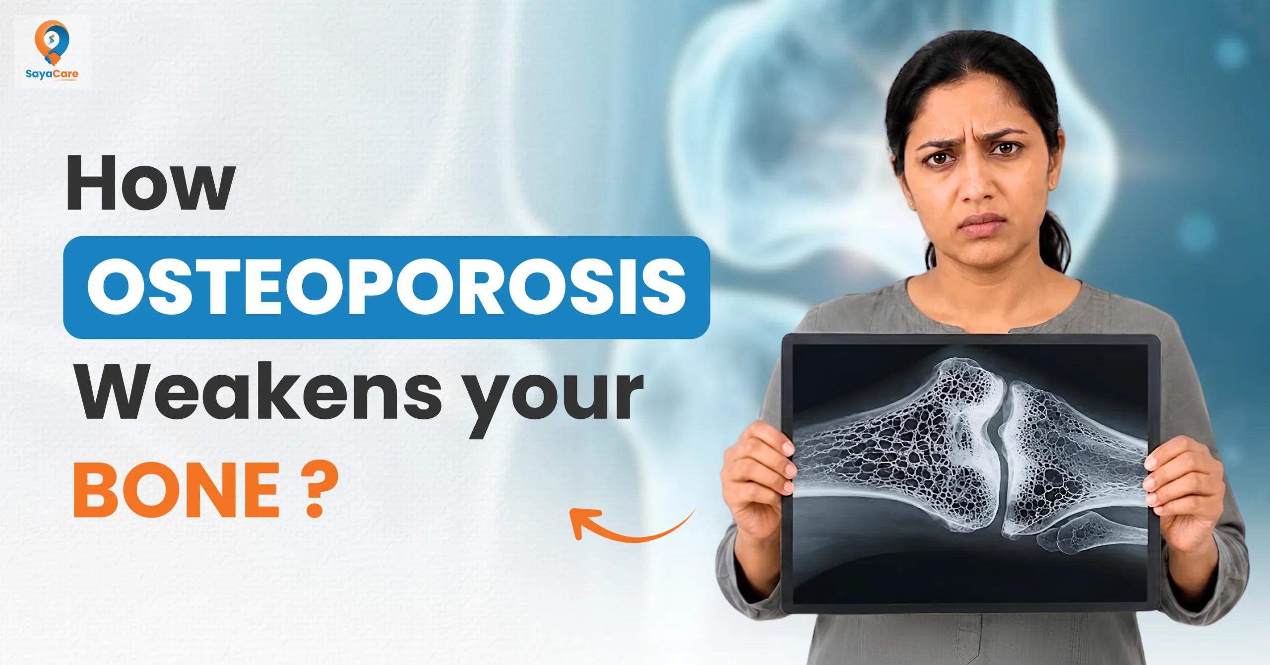 osteoporosis-why-it-happens-and-how-to-prevent
